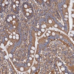 Invitrogen MRPL48 Polyclonal Antibody 100 &mu;L; Unconjugated:Antibodies,