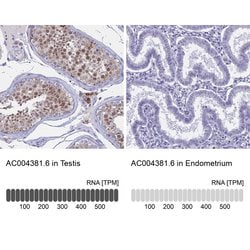 Invitrogen LOC81691 Polyclonal Antibody 100 &mu;L; Unconjugated:Antibodies,