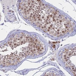 Invitrogen LOC81691 Polyclonal Antibody 100 &mu;L; Unconjugated:Antibodies,