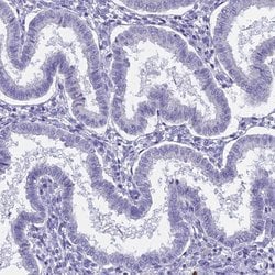 Invitrogen LOC81691 Polyclonal Antibody 100 &mu;L; Unconjugated:Antibodies,