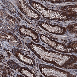 Invitrogen alanyl-tRNA Synthetase Polyclonal Antibody 100 &mu;L; Unconjugated:Antibodies,