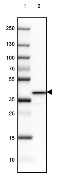 Invitrogen GNAO1 Polyclonal Antibody 100 &mu;L; Unconjugated:Antibodies,