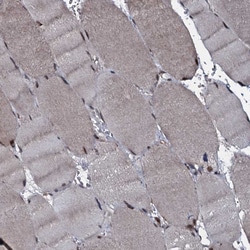 Invitrogen HDDC3 Polyclonal Antibody 100 &mu;L; Unconjugated:Antibodies,