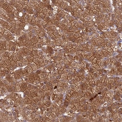 Invitrogen PGBD4 Polyclonal Antibody 100 &mu;L; Unconjugated:Antibodies,