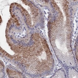 Invitrogen NUTF2 Polyclonal Antibody 100 &mu;L; Unconjugated:Antibodies,
