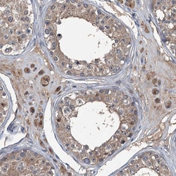 Invitrogen NAT15 Polyclonal Antibody 100 &mu;L; Unconjugated:Antibodies,