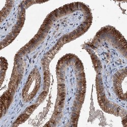 Invitrogen NAT15 Polyclonal Antibody 100 &mu;L; Unconjugated:Antibodies,