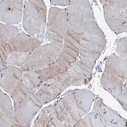 Invitrogen C18orf32 Polyclonal Antibody 100 &mu;L; Unconjugated:Antibodies,