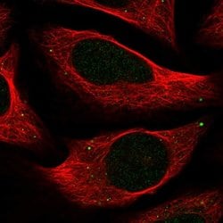 Invitrogen C18orf32 Polyclonal Antibody 100 &mu;L; Unconjugated:Antibodies,
