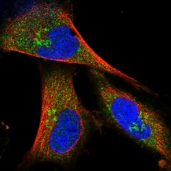 Invitrogen COG4 Polyclonal Antibody 100 &mu;L; Unconjugated:Antibodies,
