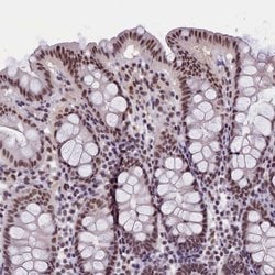Invitrogen ZC3H4 Polyclonal Antibody 100 &mu;L; Unconjugated:Antibodies,