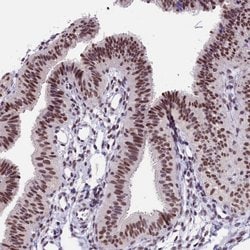 Invitrogen ZC3H4 Polyclonal Antibody 100 &mu;L; Unconjugated:Antibodies,