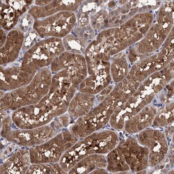 Invitrogen CPPED1 Polyclonal Antibody 100 &mu;L; Unconjugated:Antibodies,