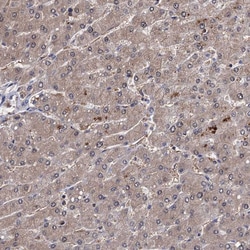 Invitrogen CPPED1 Polyclonal Antibody 100 &mu;L; Unconjugated:Antibodies,