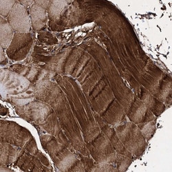 Invitrogen CPPED1 Polyclonal Antibody 100 &mu;L; Unconjugated:Antibodies,