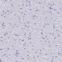 Invitrogen AHSP Polyclonal Antibody 100 &mu;L; Unconjugated:Antibodies,