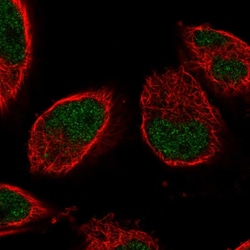 Invitrogen ALS Polyclonal Antibody 100 &mu;L; Unconjugated:Antibodies,
