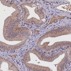 Invitrogen ALS Polyclonal Antibody 100 &mu;L; Unconjugated:Antibodies,