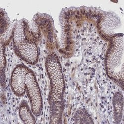 Invitrogen ALS Polyclonal Antibody 100 &mu;L; Unconjugated:Antibodies,