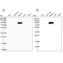 Invitrogen ALS Polyclonal Antibody 100 &mu;L; Unconjugated:Antibodies,