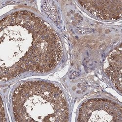 Invitrogen NUTF2 Polyclonal Antibody 100 &mu;L; Unconjugated:Antibodies,