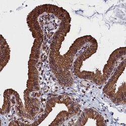 Invitrogen NUTF2 Polyclonal Antibody 100 &mu;L; Unconjugated:Antibodies,