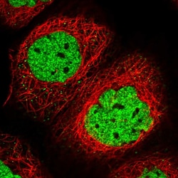 Invitrogen™ SAMD10 Polyclonal Antibody