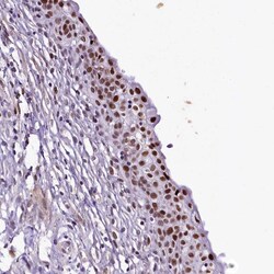 Invitrogen&trade;&nbsp;SAMD10 Polyclonal Antibody