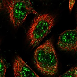Invitrogen RMI2 Polyclonal Antibody 100 &mu;L; Unconjugated:Antibodies,