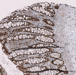 Invitrogen RMI2 Polyclonal Antibody 100 &mu;L; Unconjugated:Antibodies,