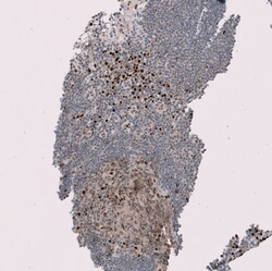 Invitrogen RMI2 Polyclonal Antibody 100 &mu;L; Unconjugated:Antibodies,