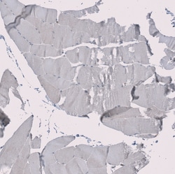 Invitrogen RMI2 Polyclonal Antibody 100 &mu;L; Unconjugated:Antibodies,