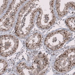 Invitrogen RMI2 Polyclonal Antibody 100 &mu;L; Unconjugated:Antibodies,