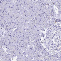Invitrogen HOMER3 Polyclonal Antibody 100 &mu;L; Unconjugated:Antibodies,