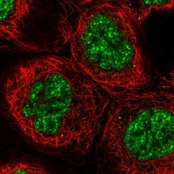Invitrogen UBE3B Polyclonal Antibody 100 &mu;L; Unconjugated:Antibodies,