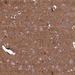 Invitrogen UBE3B Polyclonal Antibody 100 &mu;L; Unconjugated:Antibodies,