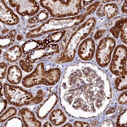 Invitrogen UBE3B Polyclonal Antibody 100 &mu;L; Unconjugated:Antibodies,