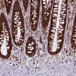 Invitrogen UBE3B Polyclonal Antibody 100 &mu;L; Unconjugated:Antibodies,