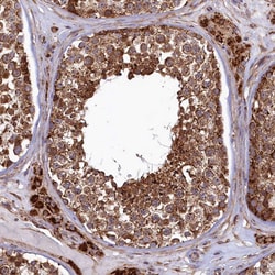 Invitrogen UBE3B Polyclonal Antibody 100 &mu;L; Unconjugated:Antibodies,
