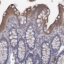 Invitrogen ACSM3 Polyclonal Antibody 100 &mu;L; Unconjugated:Antibodies,