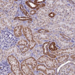 Invitrogen ACSS1 Polyclonal Antibody 100 &mu;L; Unconjugated:Antibodies,