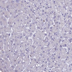 Invitrogen ACSS1 Polyclonal Antibody 100 &mu;L; Unconjugated:Antibodies,