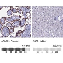 Invitrogen ACSS1 Polyclonal Antibody 100 &mu;L; Unconjugated:Antibodies,