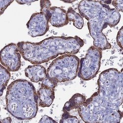 Invitrogen ACSS1 Polyclonal Antibody 100 &mu;L; Unconjugated:Antibodies,