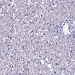 Invitrogen ACSS1 Polyclonal Antibody 100 &mu;L; Unconjugated:Antibodies,