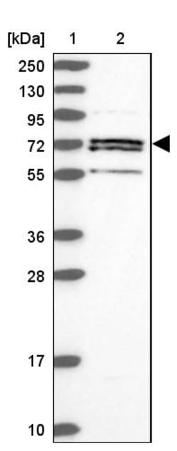 Invitrogen ACSS1 Polyclonal Antibody 100 &mu;L; Unconjugated:Antibodies,