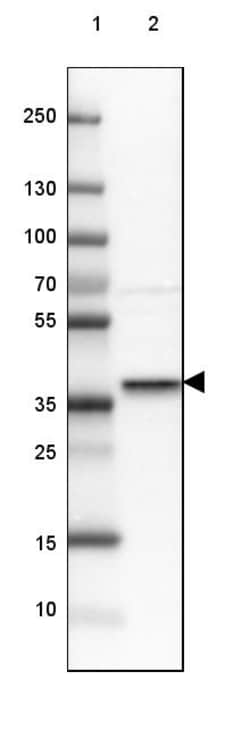 Invitrogen STX16 Polyclonal Antibody 100 &mu;L; Unconjugated:Antibodies,