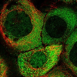 Invitrogen KIAA1609 Polyclonal Antibody 100 &mu;L | Buy Online | Invitrogen&trade; | Fisher Scientific