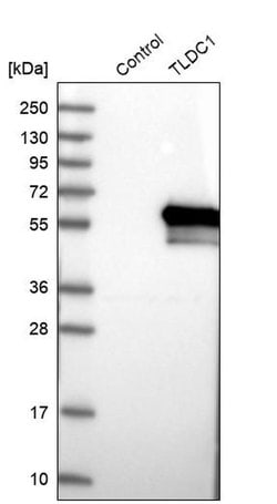Invitrogen KIAA1609 Polyclonal Antibody 100 &mu;L | Buy Online | Invitrogen&trade; | Fisher Scientific