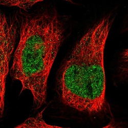 Invitrogen&trade;&nbsp;C20orf177 Polyclonal Antibody